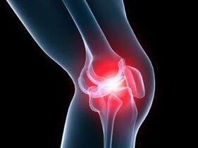 Osteoarthritis causes knee pain