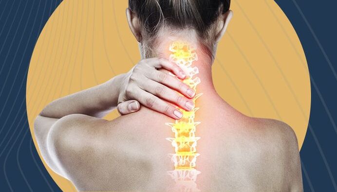 symptoms of cervical spondylosis