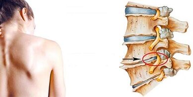 Cervical bone development mechanism