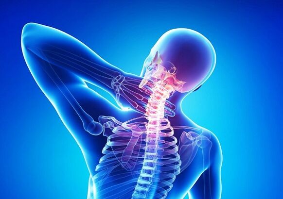 Pain in the cervical spine with osteoarthritis