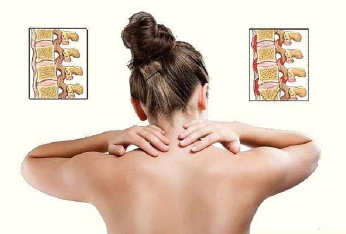 Cervical spondylosis is the cause of pain under the left shoulder blade