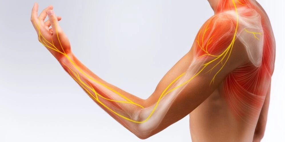 Pain and numbness in the fingers indicate ligament damage due to stenotic tendonitis